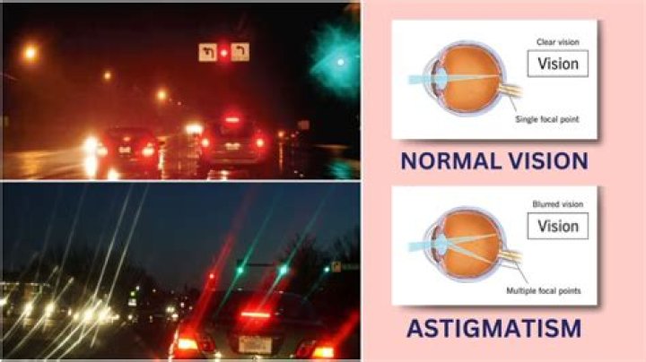 Is astigmatism 0 25 bad